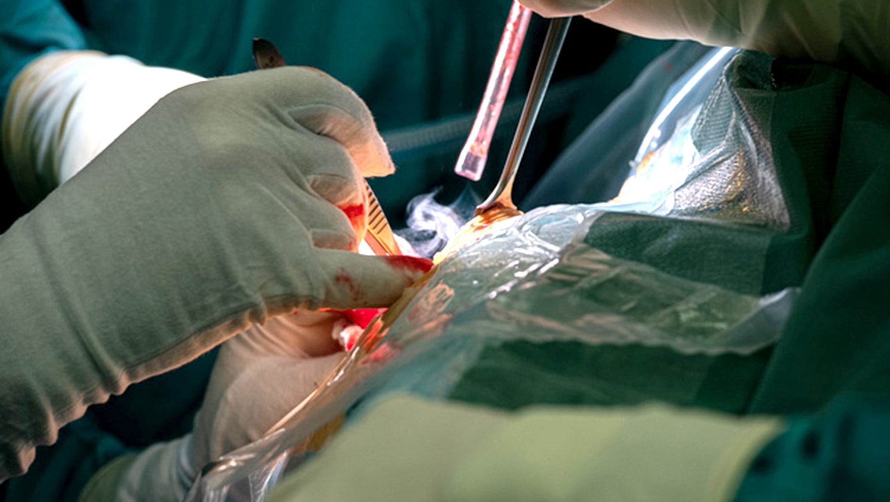 Chirurgische Operation