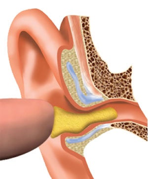 Gehörschutz im Ohrkanal 
