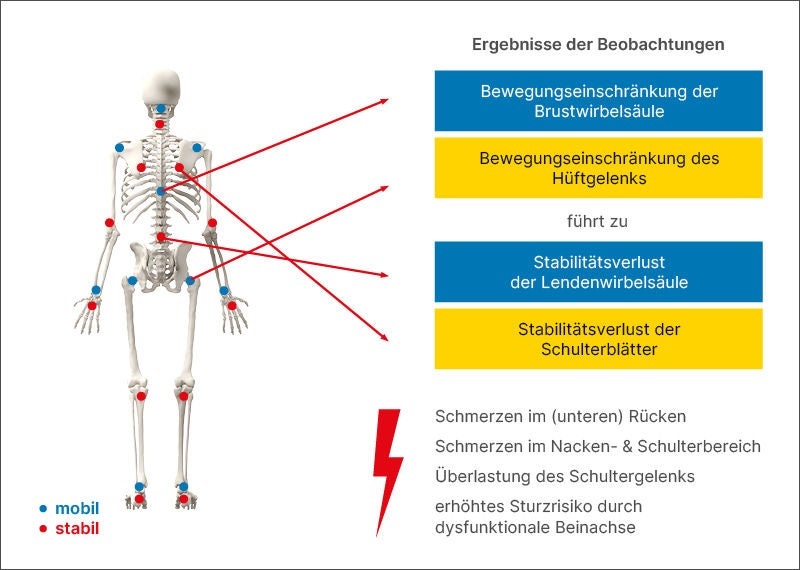 Skelettdarstellung mit blau markierten mobilen und rot markierten stabilen Gelenken; Pfeile zeigen, wie Bewegungseinschränkungen der Brustwirbelsäule und des Hüftgelenks zu Stabilitätsverlust der Lendenwirbelsäule und der Schulterblätter führen, mit daraus resultierenden Beschwerden wie Rücken- und Nackenschmerzen.